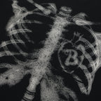 X-Ray Skeleton Graphic T-shirt
